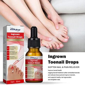 10 мл Серум за лечение на врастнали нокти на краката, Възстановително масло за корекция на ноктите, Обезболяващо средство